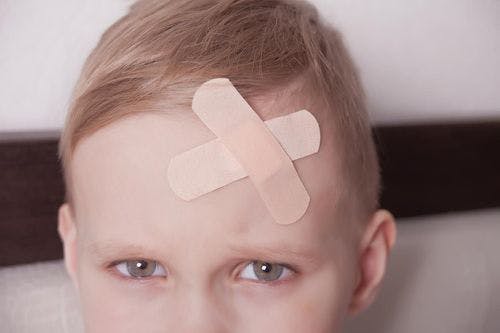 child with bandaids on forehead